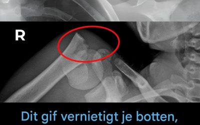 Deze drank vernietigt je botten van binnenuit, maar iedereen drinkt het toch.
