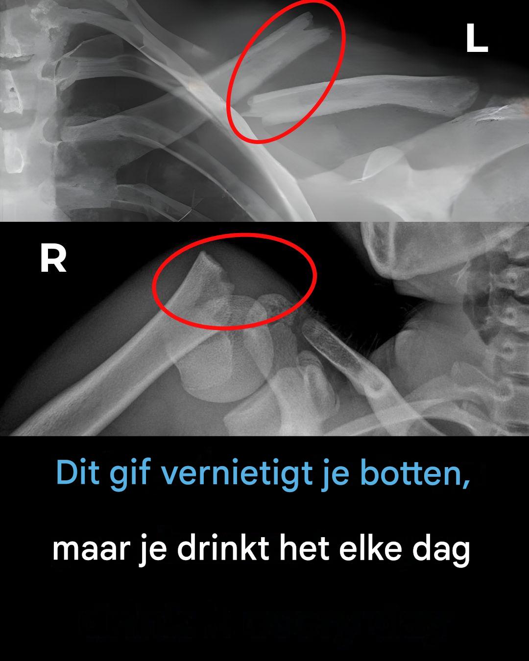 Deze drank vernietigt je botten van binnenuit, maar iedereen drinkt het toch.