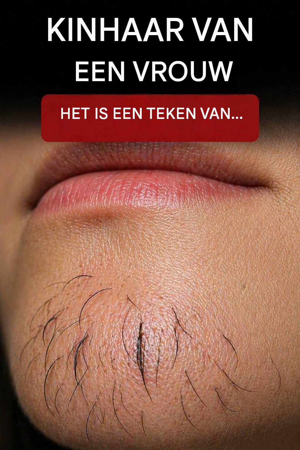 Waarom krijgen sommige vrouwen gezichtsbeharing? Oorzaken en oplossingen