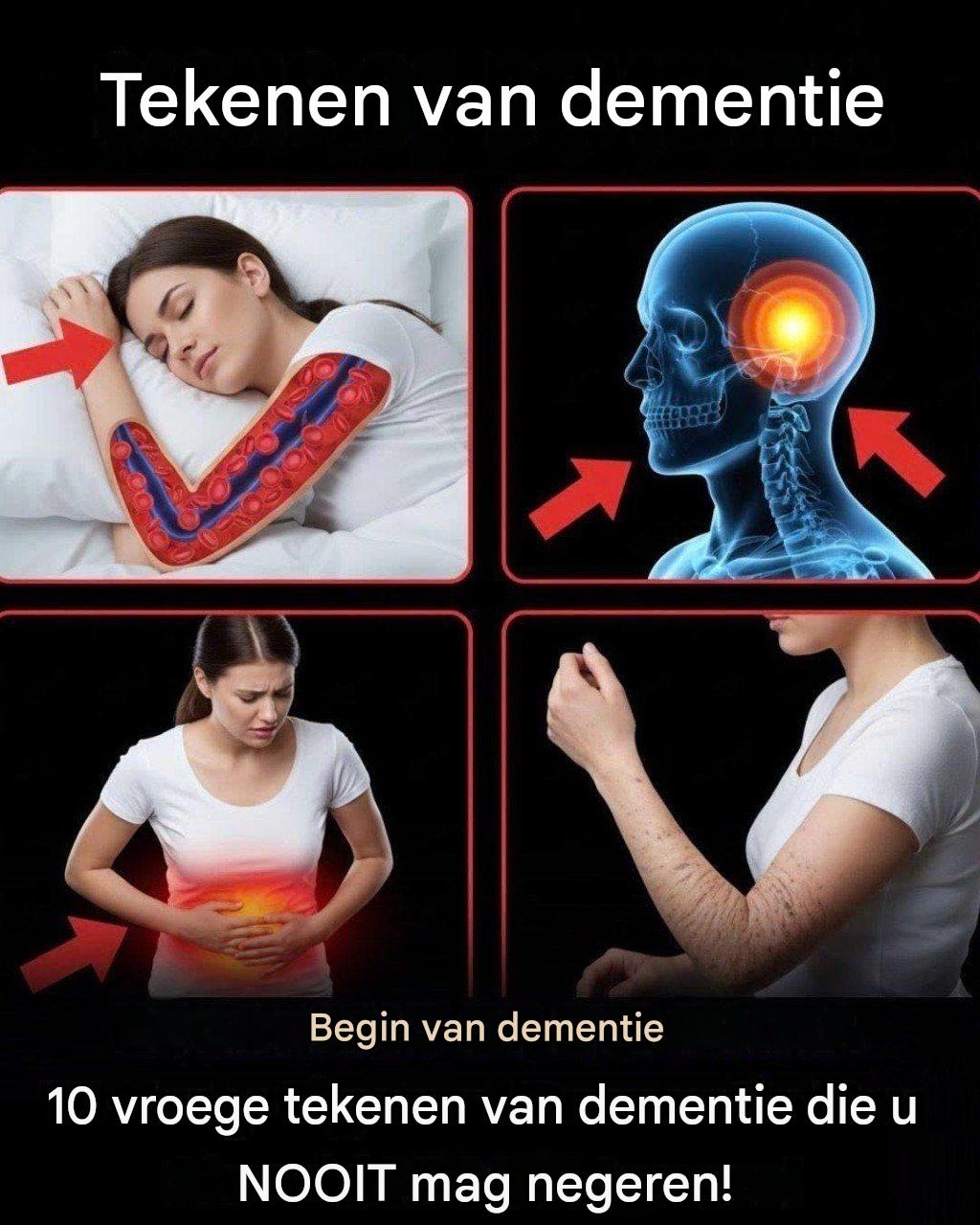 10 vroege tekenen van dementie die u NOOIT mag negeren!