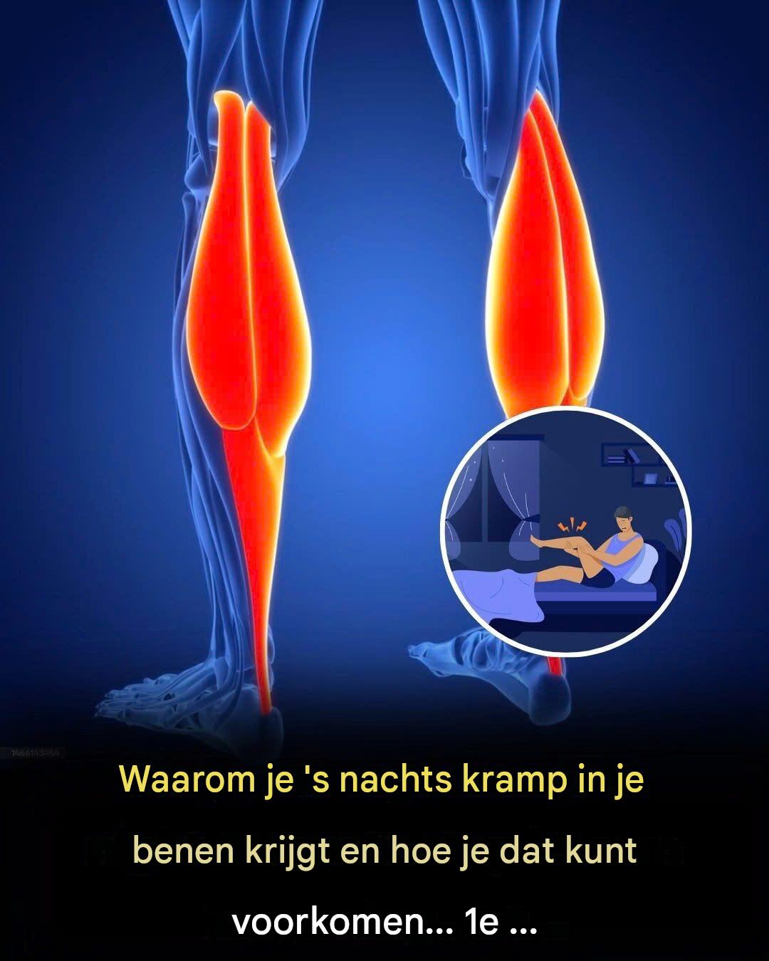 Waarom ontstaan ​​beenkrampen tijdens het slapen? Experts onthullen de meest voorkomende oorzaken.