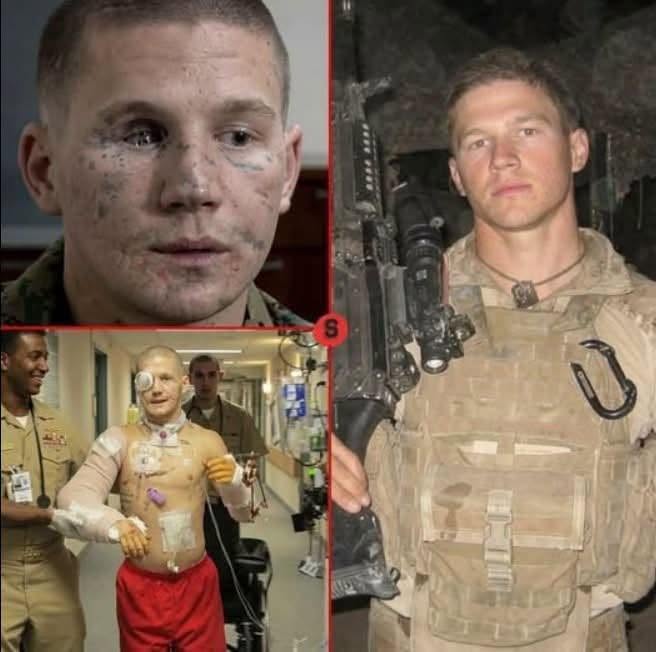 Kyle Carpenter: de marinier die zich voor een granaat wierp om zijn kameraad te redden.