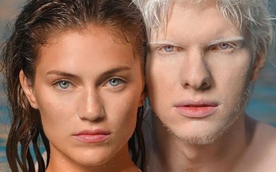 De vrienden van meer albino’s en een topmodel hebben een charme gecreëerd die de sociale kringen elektrisch maakt