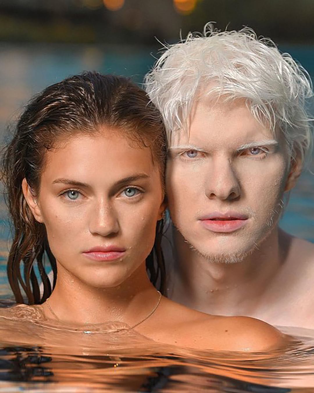 De vrienden van meer albino’s en een topmodel hebben een charme gecreëerd die de sociale kringen elektrisch maakt